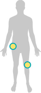knee